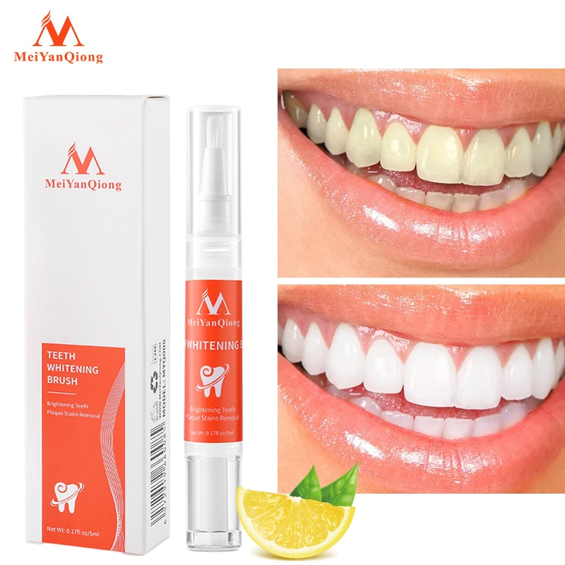 Theet® - Caneta Clareadora Dental