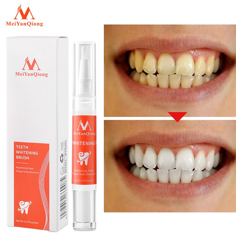 Theet® - Caneta Clareadora Dental