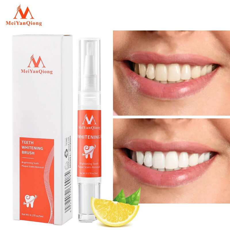 Theet® - Caneta Clareadora Dental