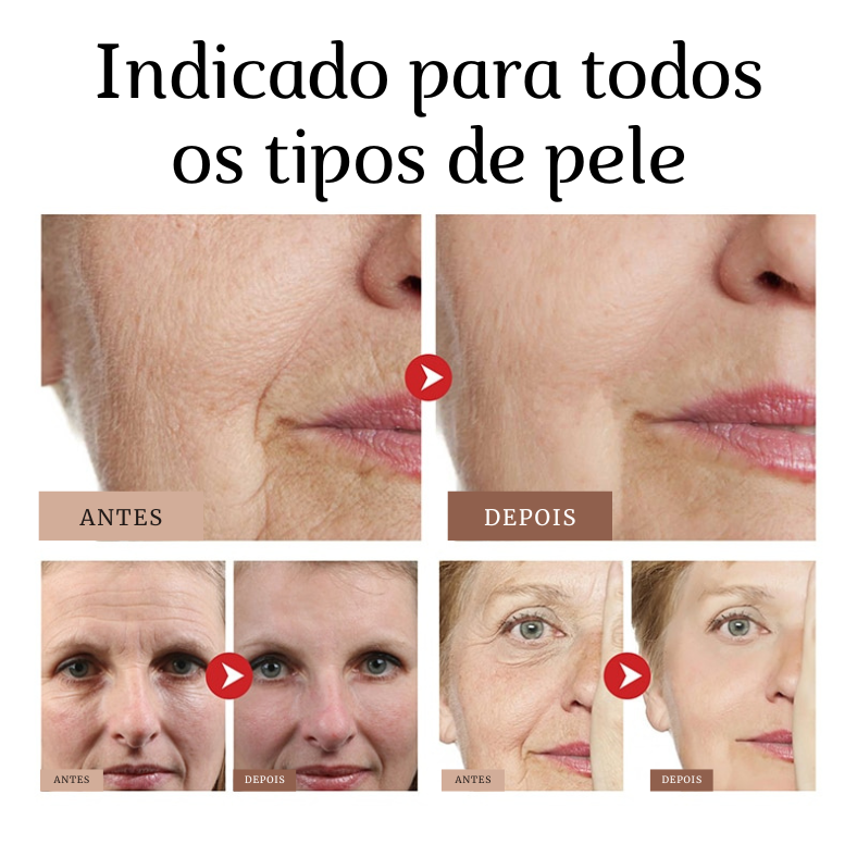 Vital Lifting® - Creme Facial de Firmeza e Efeito Lifting