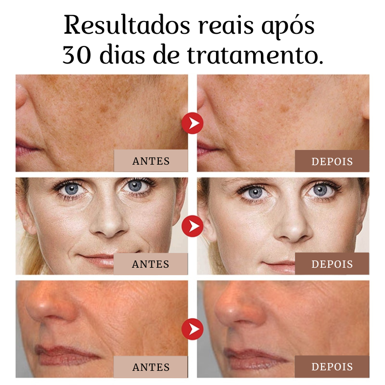 Vital Lifting® - Creme Facial de Firmeza e Efeito Lifting